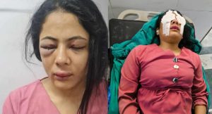 नयाँबानेश्वरमा रिपोर्टिङ गर्दा घाइते पत्रकार सविना कार्कीप्रति सञ्चारिका समूहको ध्यानाकर्षण